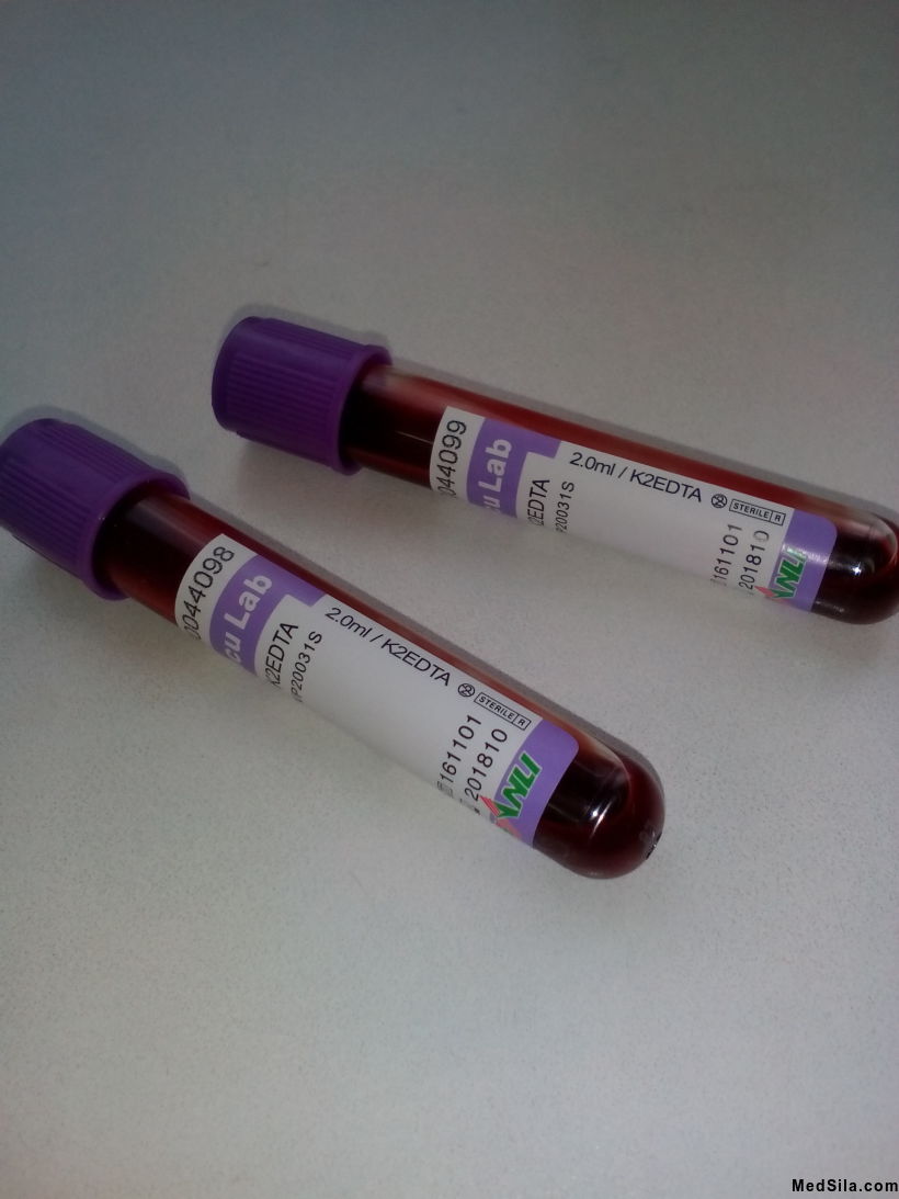 Вакутайнеры  с ЭДТА (с цитратом натрия), предназначены для анализа крови.