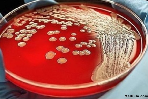 Рост бактерий на питательной среде